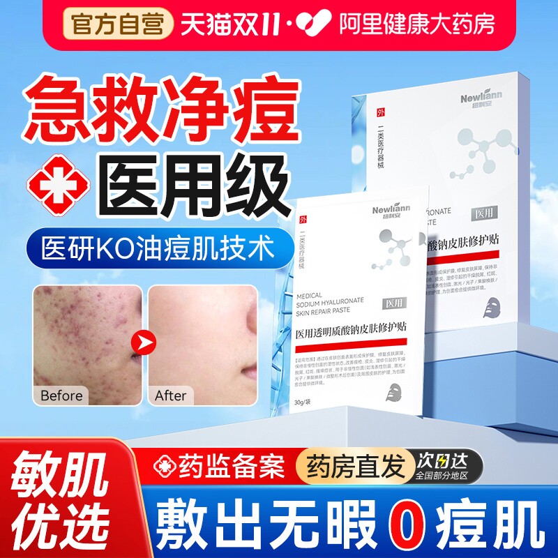 医用冷敷贴去痘淡化痘印收缩毛孔消炎修复痤疮补水械字号非面膜型