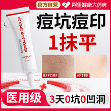 医用型重度痘坑凹洞修复生长因子祛痘印修复淡化痘印去黑色素沉淀