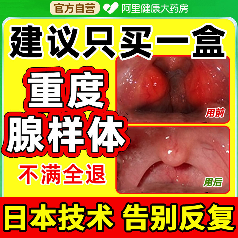 儿童腺样体面容贴扁桃体中药鼻炎肥大肿大腺体调理治保健呼吸疗