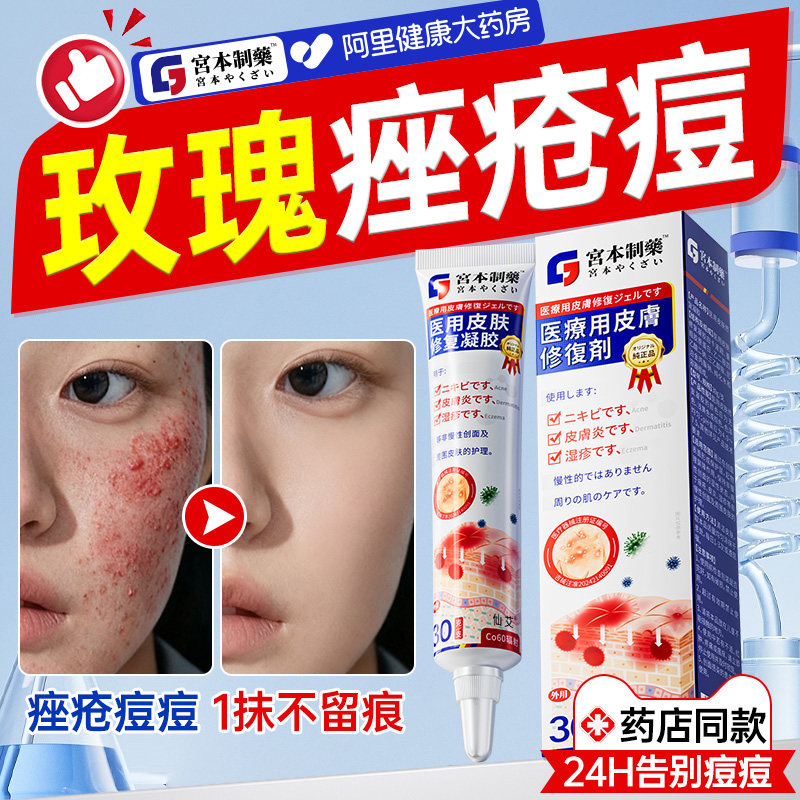 【日本技术】痘痘玫瑰痤疮软膏
