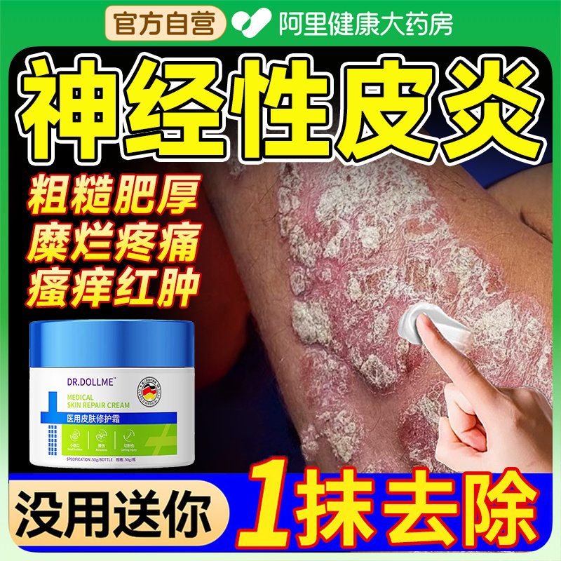 治疗神经性皮炎疹止皮肤瘙痒顽固癣藓根祛去除外用膏特药房效湿疹