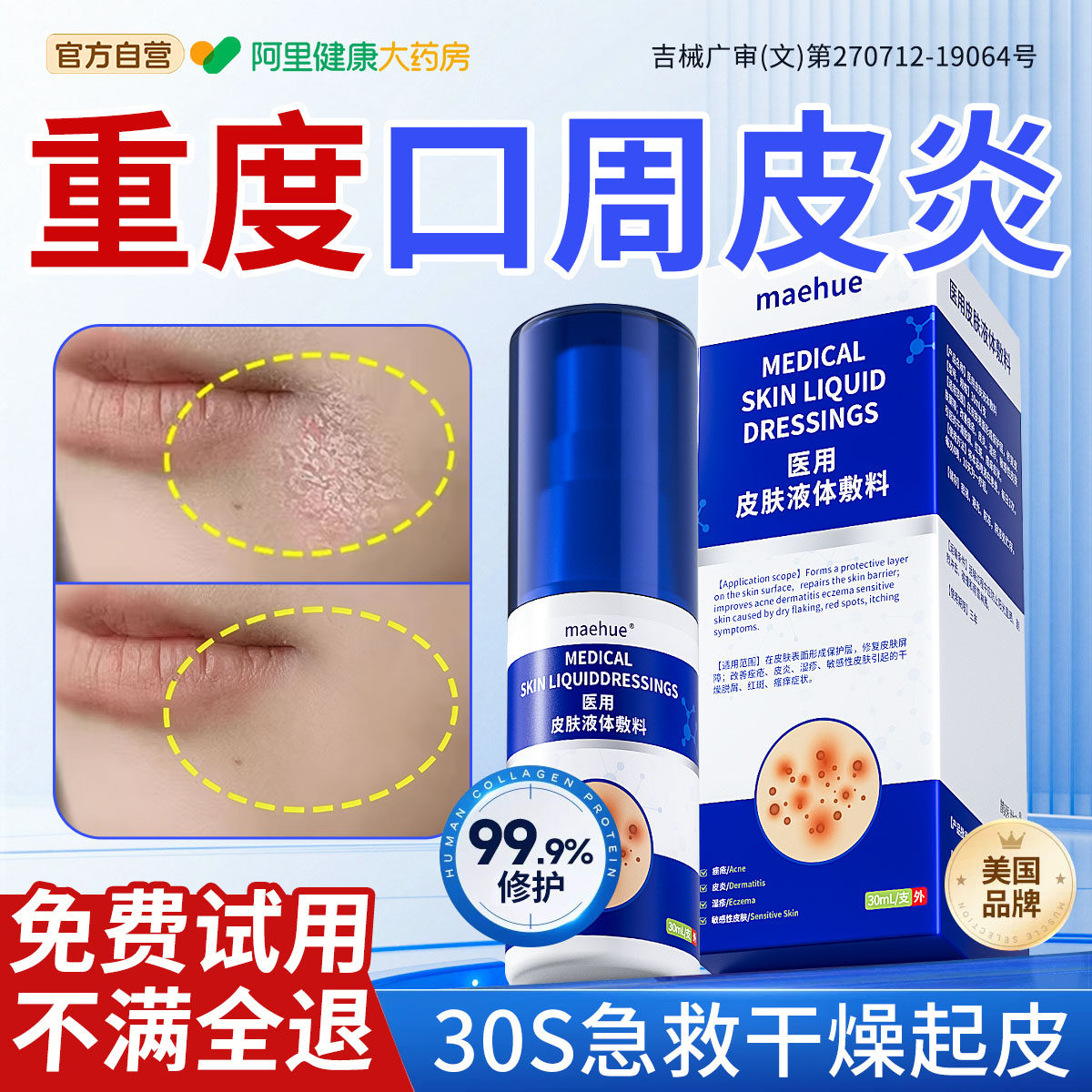 嘴角干燥起皮口周皮炎口角烂嘴角药膏嘴唇上火起泡脂溢性面部嘴巴