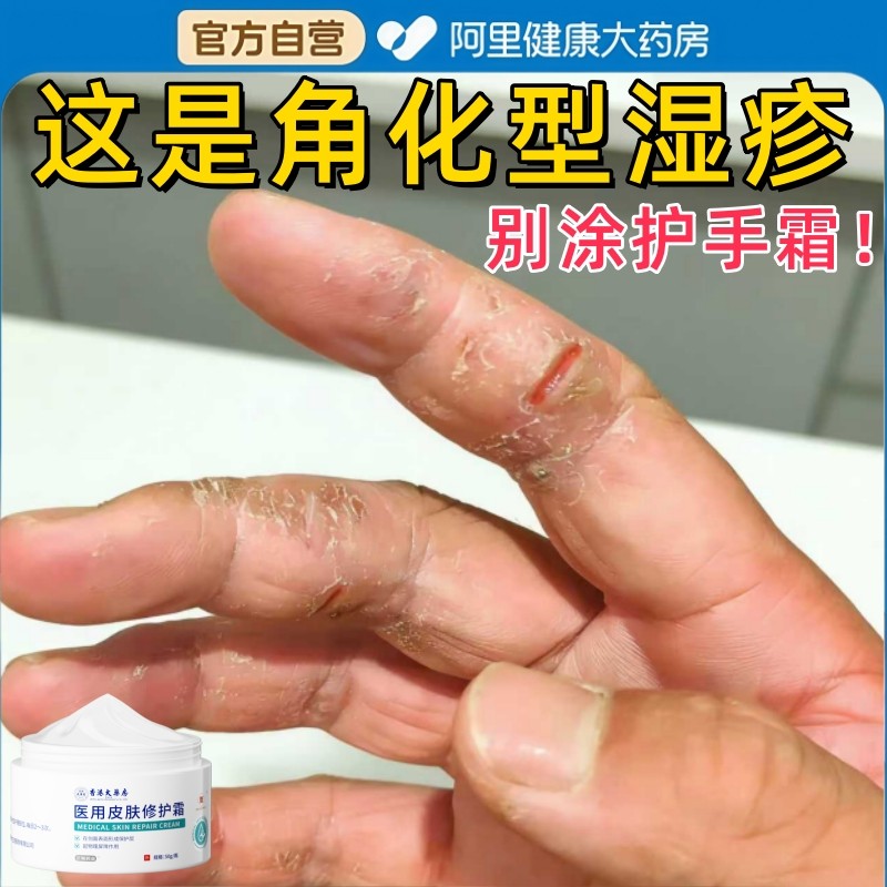 手指裂口出血角化型皮肤修复霜开裂手足皲裂膏起硬皮干燥脱皮正品,医疗器械,医用乳膏（器械）,淘宝优惠券,粉丝福利购,淘宝优惠卷
