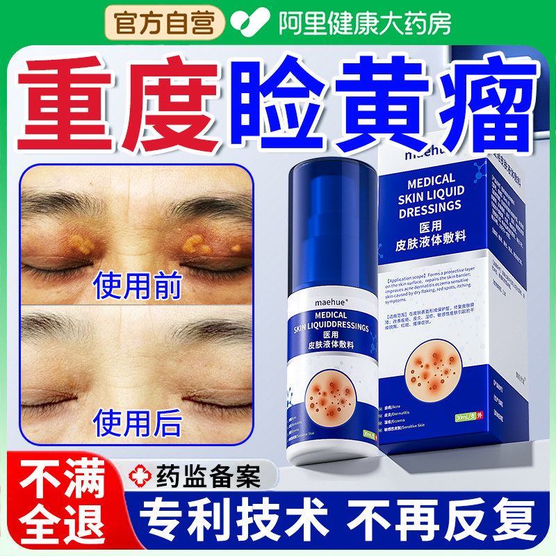 眼睑黄瘤去除神器扁平疣睑黄瘤眼角脂肪粒去除膏贴去眼角皮黄斑