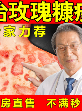 玫瑰糠疹专用白色糠疹脸部膏除儿童脸上长白斑湿疹皮炎软膏根婴儿