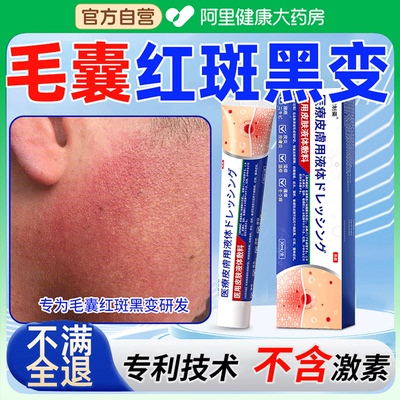 面颈部毛囊红斑黑变病面部脸颊两边有起小疙瘩毛周角化症儿童脸红