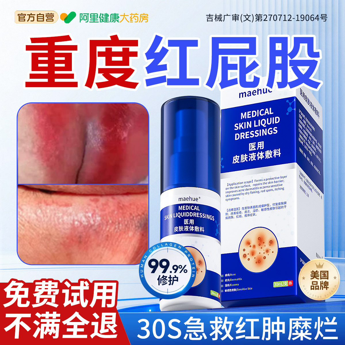 卧床老人红屁股药膏尿布疹去皮炎真菌感染除皮肤红肿烂破皮止瘙痒
