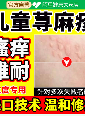 儿童寻荨麻疹过敏风团止膏断过敏药膏急性慢性瘙痒性提高免疫力药