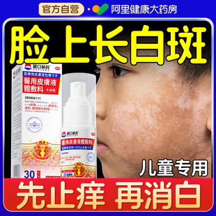 白色糠疹药膏儿童脸上长白斑皮肤干燥止痒汗斑花斑癣脸部皮肤抑菌