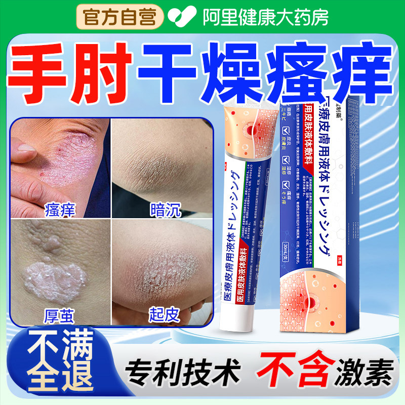 手肘干燥起皮瘙痒开裂关节癣增厚胳膊肘去黑死硬皮膏神经性皮炎