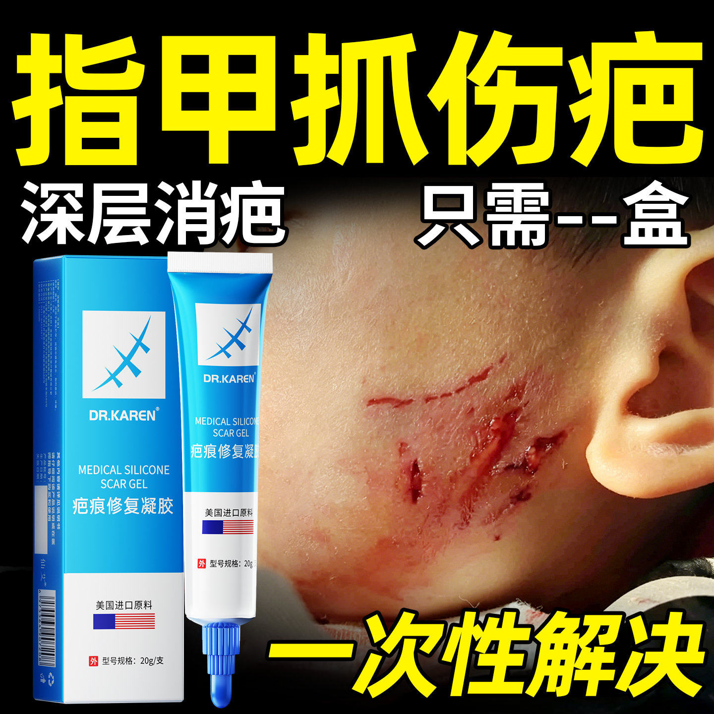 指甲抓伤疤痕祛疤膏巴克儿童专用修复脸部除增生凸起淡化色素沉淀