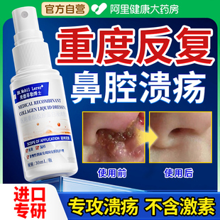 儿童鼻黏膜鼻子鼻腔溃疡修复凝胶干燥滋润保湿喷雾专用特效结痂膏