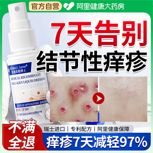 结节性痒疹特效治顽固红硬疙瘩皮肤湿疹皮肤瘙痒止痒外用特效去