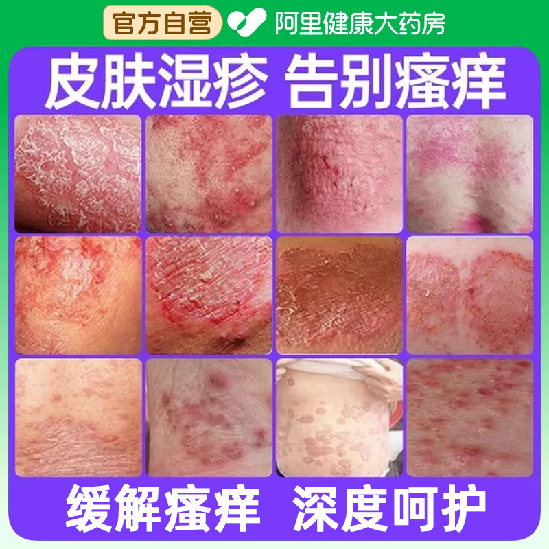止痒泡澡药包中药皮肤瘙痒湿疹皮炎药浴成人儿童内热体藓红斑泡脚图片