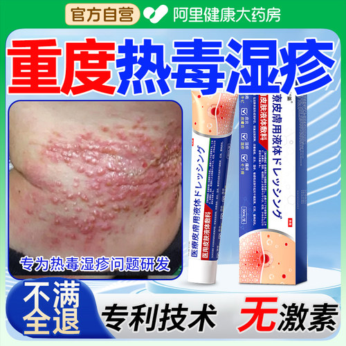 治疗湿疹皮肤一热就痒效去清热凉血解毒药膏