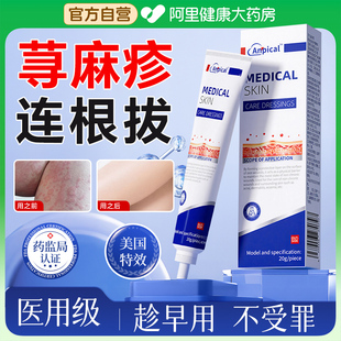 进口寻荨麻疹过敏皮肤止痒特断风团划痕性丘疹胆碱性根慢性效用膏
