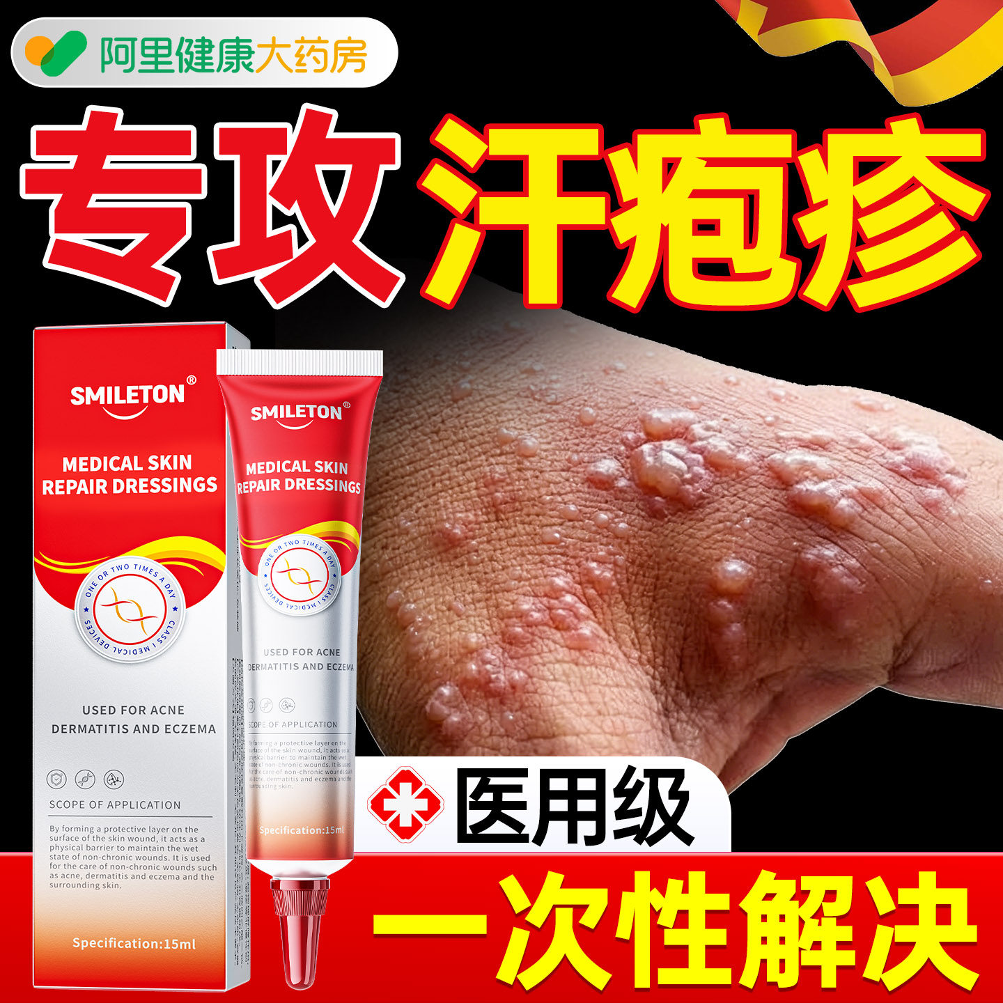 汗疱疹手上起真菌感染水泡湿疹止痒长疙瘩脱皮杀菌手指抑菌专用