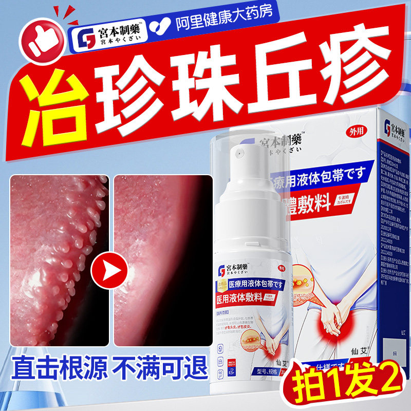 珍珠丘疹专用男士龟头炎冠状沟颗粒去除阴茎小疙膏状真菌感染喷剂