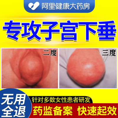 子宫下垂中药贴子宫下垂托治疗产后提升宫颈脱垂中老年人训练器