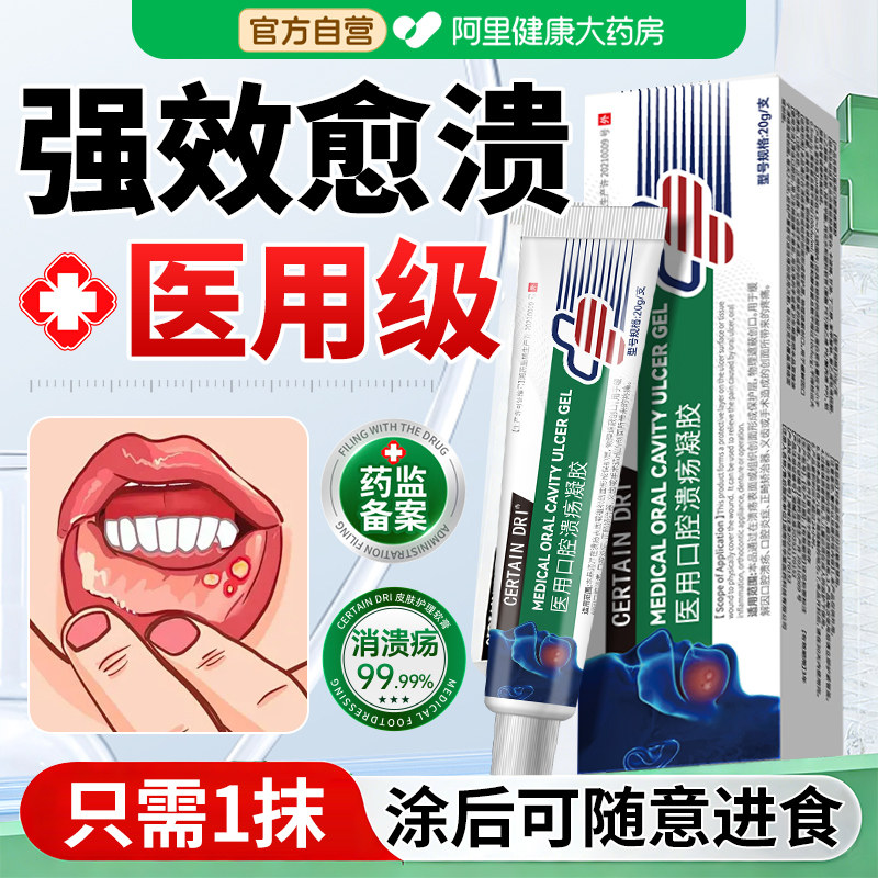 口腔溃疡凝胶儿童成人专用药上火嘴巴炎症舌头起泡非西瓜霜贴喷剂