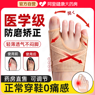 拇指外翻小趾内翻脚趾无痛矫正器脚趾头分离纠正分趾器大脚骨