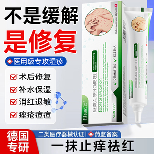 湿疹药膏外用止痒皮炎药膏肛周肛门阴囊瘙痒去顽固皮炎汗疱疹软膏