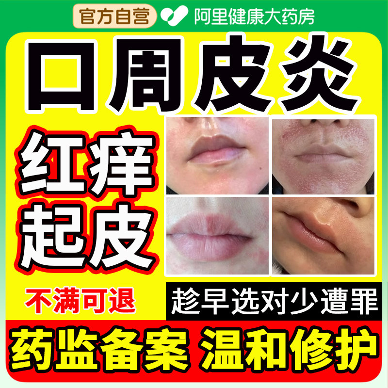 口周皮炎嘴唇起皮嘴角干燥嘴巴周围红斑丘疹瘙痒过敏泛红药膏周炎