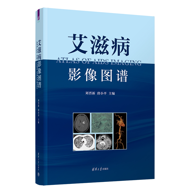 艾滋病影像图谱刘晋新