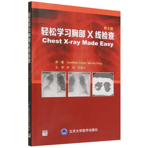 轻松学习胸部X线检查