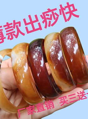 买五送二精品爆款玛瑙刮痧手镯薄款美容店足疗店用品养生正品手镯
