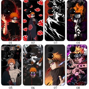 一加 活力版 适用 Nord Pro Note Ace N20 Z7i 11T OPPO 红米 火影忍者佩恩 12T手机壳 iQOO