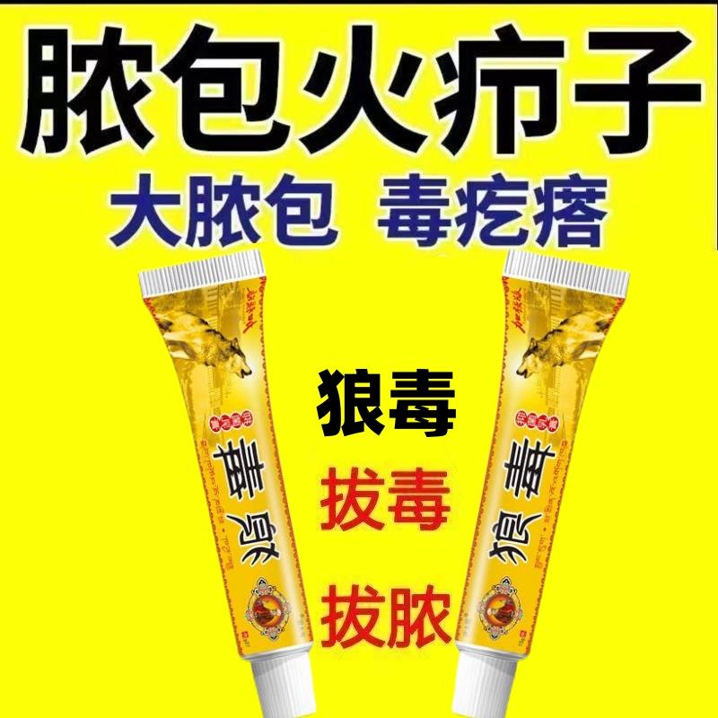 火疖子拔毒膏贴硬疙瘩浓包红肿痘痘坐板疮拔脓膏硬块毛囊吸脓神器