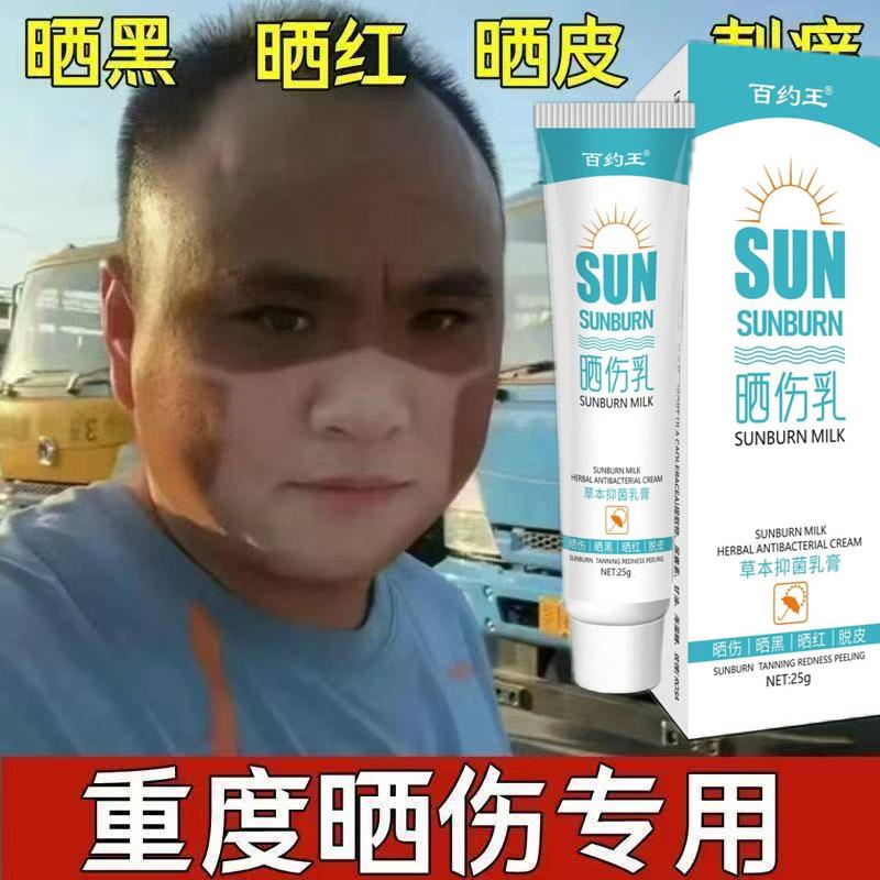 晒伤乳液紫外线过敏专用太阳晒伤皮肤发痒日光性皮炎除止晒后修复