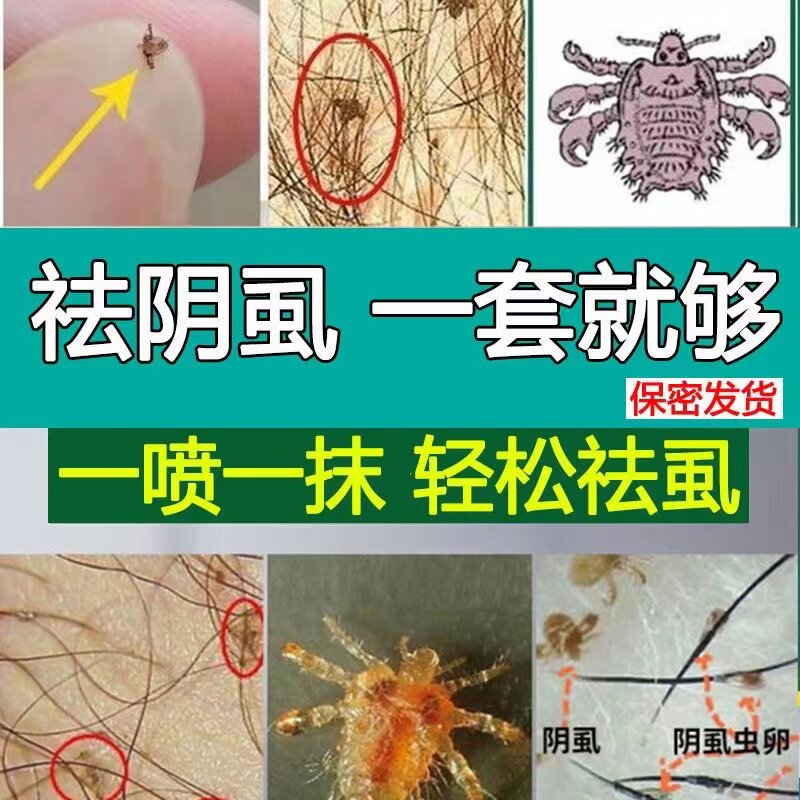 硫软膏男女私处阴虱子专用药私处灭阴虱成人私处瘙痒杀虫止痒药膏