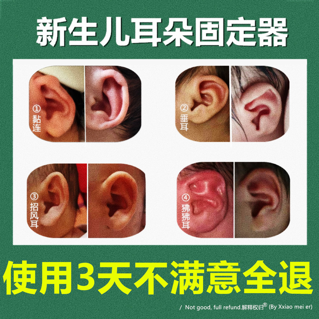 耳朵矫正器婴儿纠正垂耳招风耳定型新生的儿耳夹固定宝宝耳廓神器