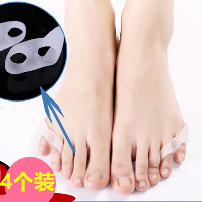 脚指内翻分趾器小脚趾小拇指外翻矫正器 保护套拇外翻重叠趾分离