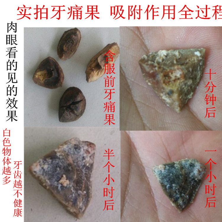 中草牙痛果子牙洞疼蛀牙周发红肿牙龈肿痛上火龋齿效炎本草天然,洗护清洁剂/卫生巾/纸/香薰,口鼻清洁杀菌消炎剂,淘宝优惠券,粉丝福利购,淘宝优惠卷