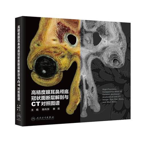 正版包邮  高精度眼耳鼻颅底冠状面断层解刨与CT对照图谱 9787117389396 陈向东,蔡莉 人民卫生出版社