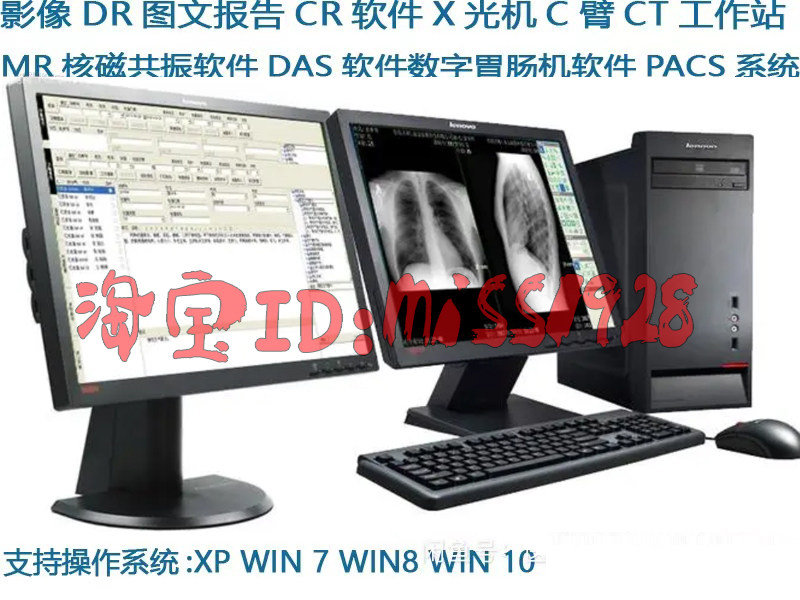 CT软件CT工作站X光机数字胃肠DR软件CR软件核磁MRI软件Win7/Win10