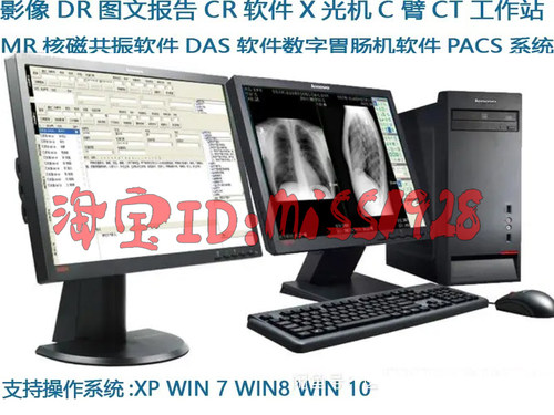 CT工作站CR软件PACS软件MR核磁