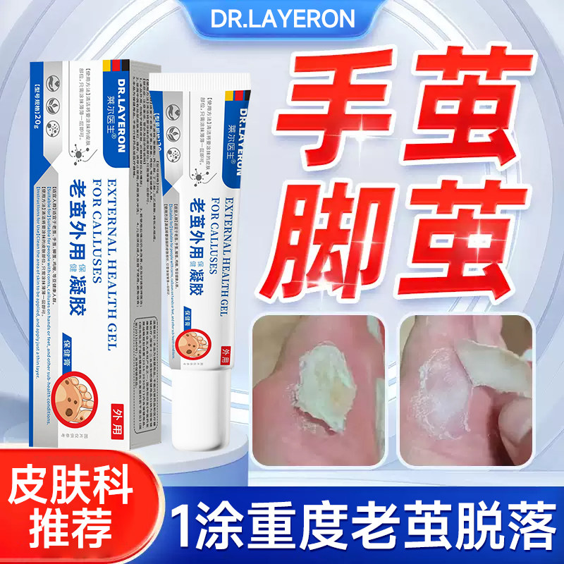 脚底老茧去除软化剂去死皮根脚垫药膏神器根去硬皮脚钉祛除鸡茧眼