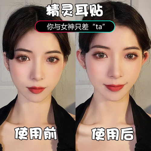 精灵耳贴神器贴面耳变招风耳立
