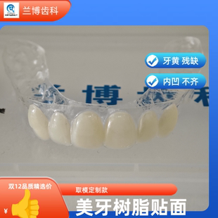 隐形美牙贴片贴面 牙套 牙齿黄内凹缺牙 美白遮挡牙贴片门牙遮挡