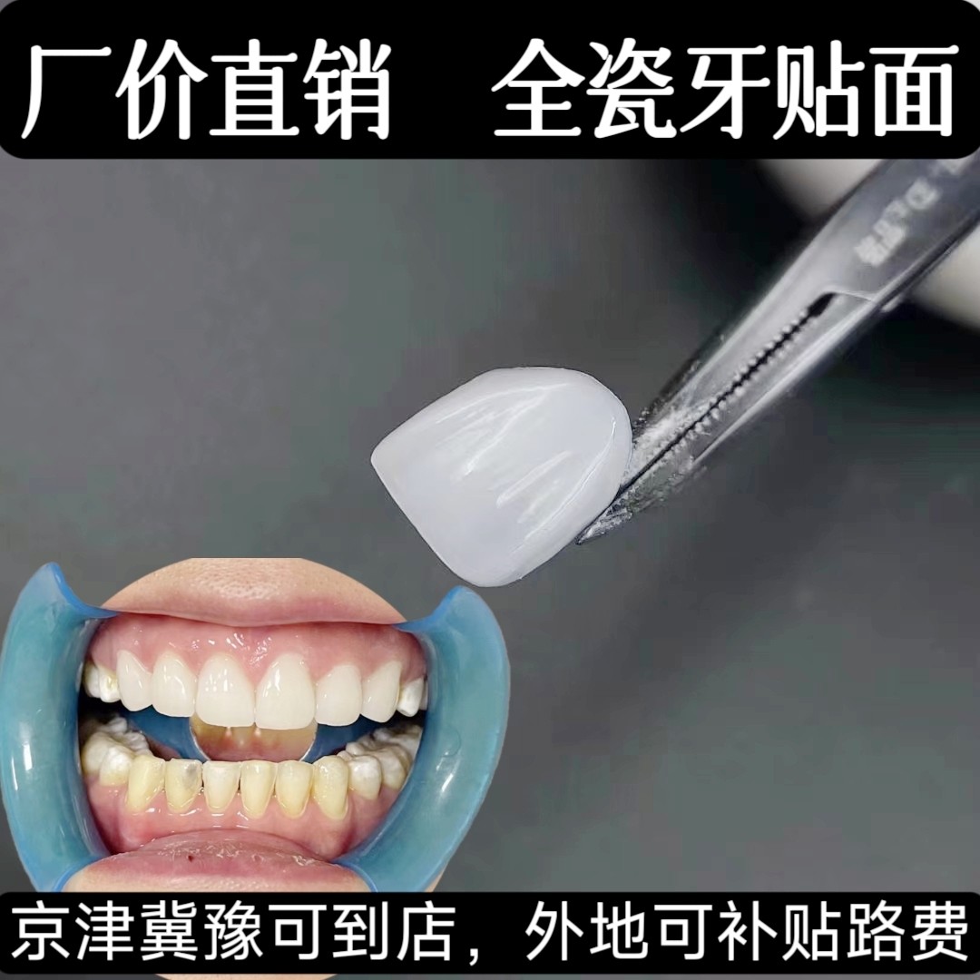 美牙神器 黄牙 残缺牙牙缝大 隐形美白美牙贴片贴面 全瓷玻璃水晶