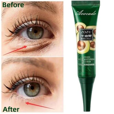 Anti Dark Circles Bags Instant Remove Wrinkles Eye Cream Puf