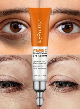 Eye Cream Anti Dark Circle Remove bags under eyes VC Whiteni