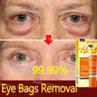 Instant Eye Bag Remove Eye Cream Fade Eye Fine Line Dark Cir