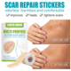 Sheet Multi Tape Scar Treatment Repair Silicone Skin purpose