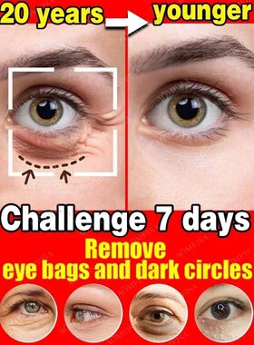 Anti-Wrinkle Eye Cream Dark Circles Remove Eye Bags Puffy Re