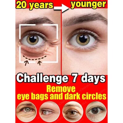 Anti-Wrinkle Eye Cream Dark Circles Remove Eye Bags Puffy Re